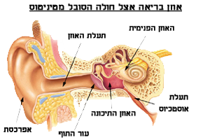 אוזן בריאה בחולה טיניטוס